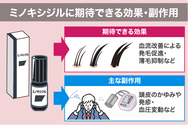 ミノキシジルに期待できる効果・副作用を解説している画像